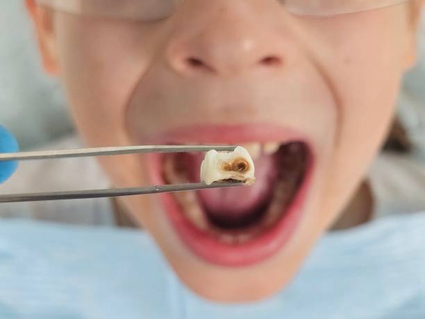 Best Emergency Dental Care for Sports Injuries in Leitchfield, KY